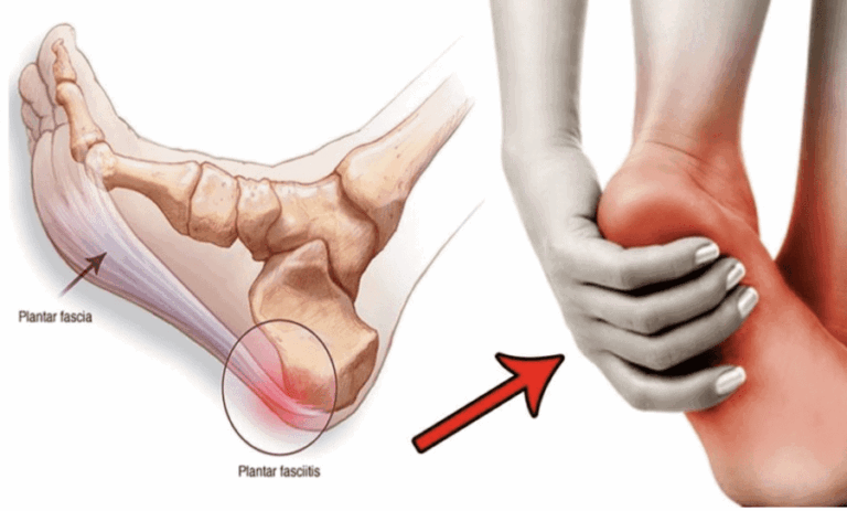 Heel Pain Physiotherapy Services in Nairobi