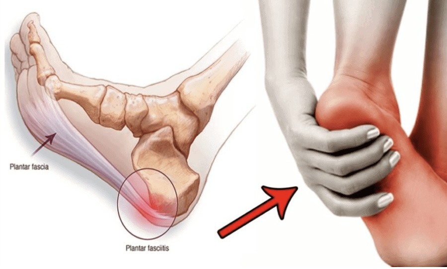 Heel Pain Physiotherapy Services in Nairobi