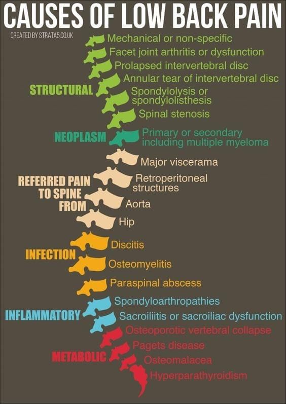 Causes of Low Back Pain